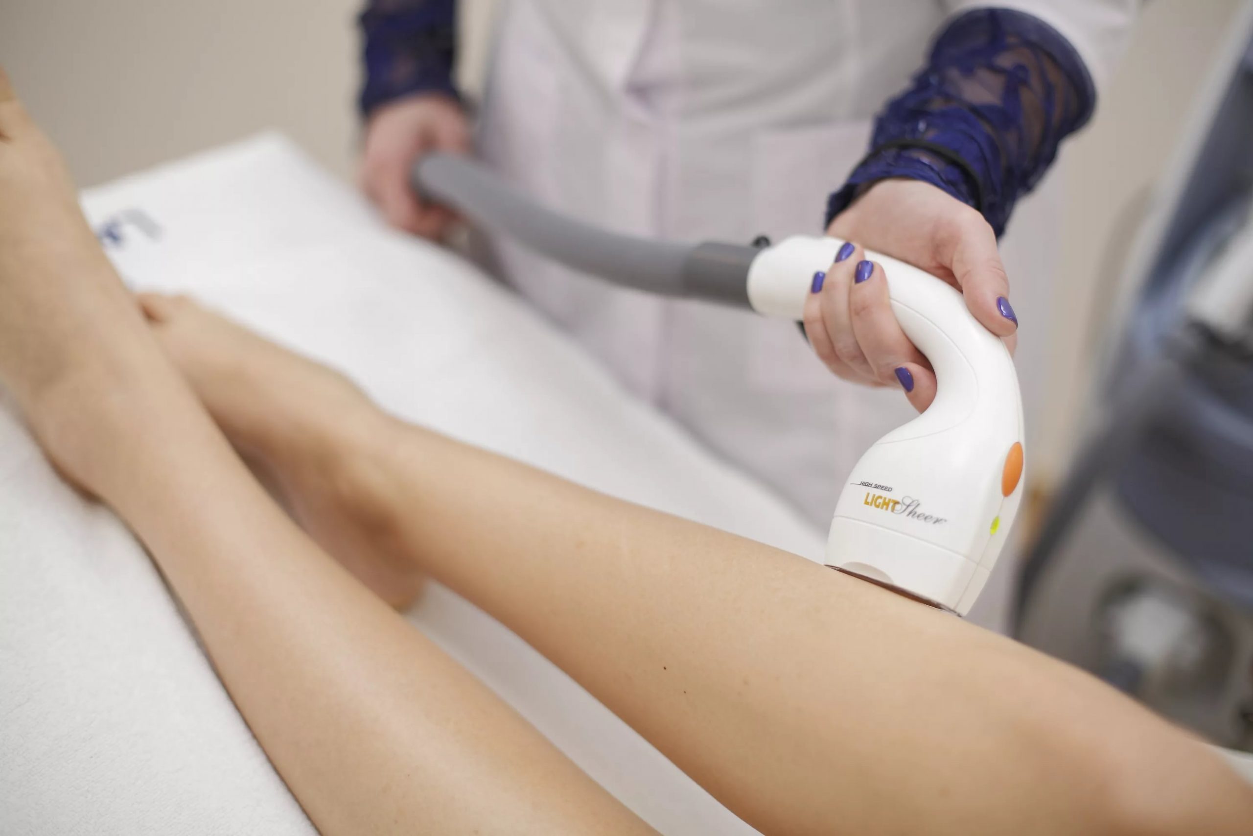 Преимущества лазерной эпиляции